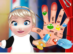 Baby Elsa Hand Doctor
