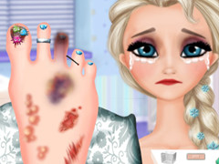 Elsa Foot Injured